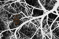 ganglia